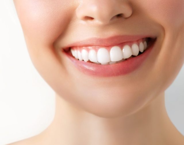 Smiling woman with bright, healthy teeth, representing winter oral health tips for maintaining dental wellness in Saratoga Springs.
