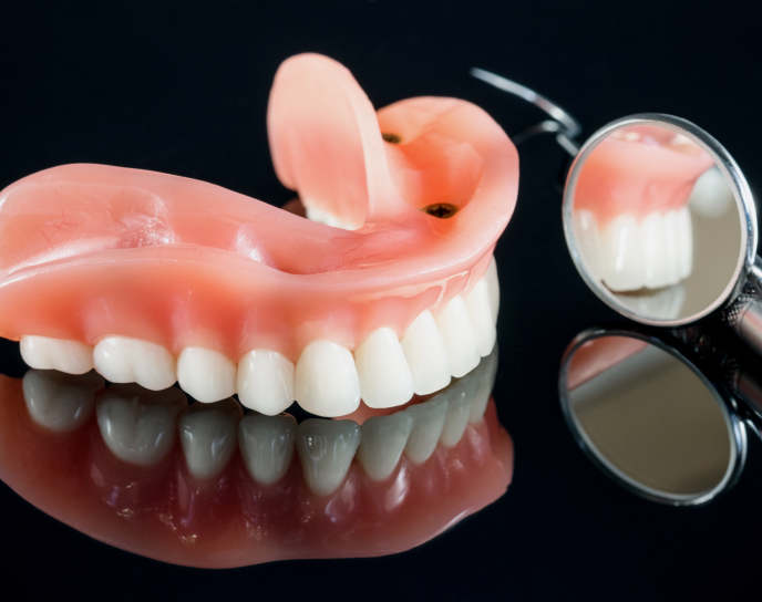Overdentures displayed on a reflective surface with a dental mirror, illustrating removable dentures designed for stability over dental implants, relevant to restorative dentistry services.