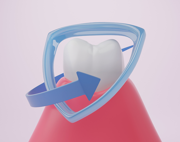 Dental sealant application on a tooth, showcasing protective resin barrier against cavities, emphasizing preventive dental care at Linrose Dental in Saratoga Springs.