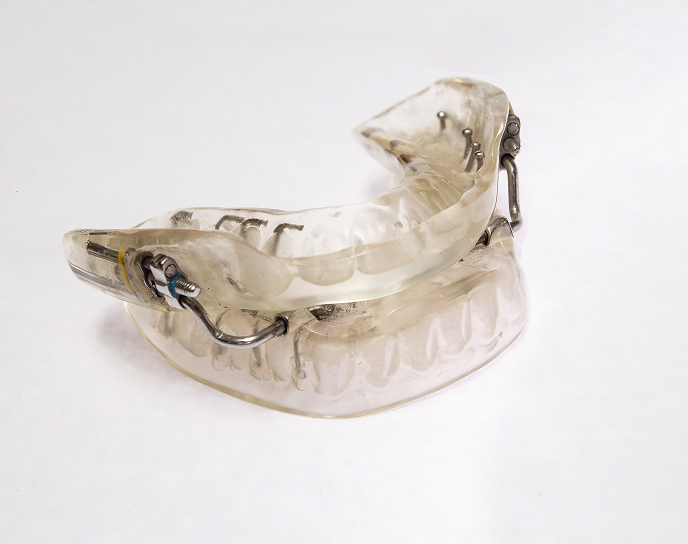 Custom-made sleep apnea oral device for comfortable nighttime use, designed to keep airways open and improve sleep quality.