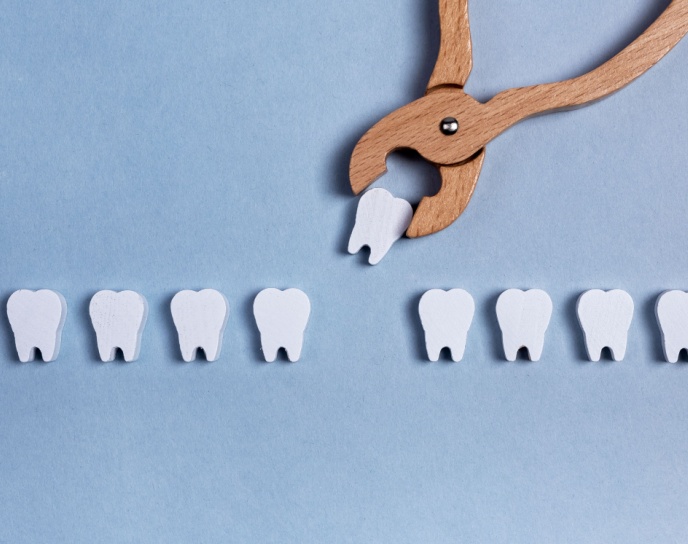 Dental extraction process with wooden pliers grasping a white tooth model, illustrating tooth removal in a dental context.